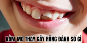 Nằm Mơ Thấy Gãy Răng Đánh Số Gì 22 Anh Thumb bai viet 3 min1 5