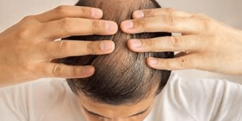 Nằm Mơ Thấy Rụng Tóc Đánh Số Gì: Giải Mã Giấc Mơ Và Điềm Báo 2 Các tình huống rụng tóc trong nằm mơ thấy rụng tóc đánh số gì